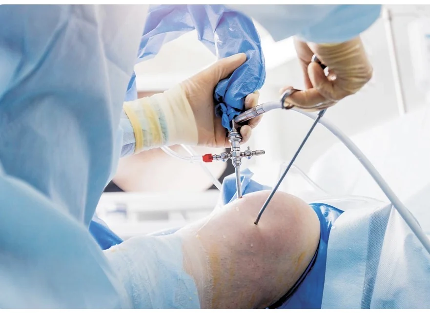 Knee arthroscopy in theatre: the surgeon holding the arthroscope and a working instrument through two small incisions in the knee.